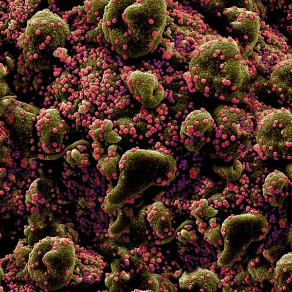 Pink Virus on Green Cells thumb